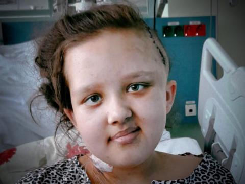 Dla 11-letniej Julki szpital stał się drugim domem. W jej głowie lekarze wykryli trzy ogromne guzy